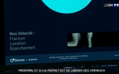 L’IA en imagerie médicale